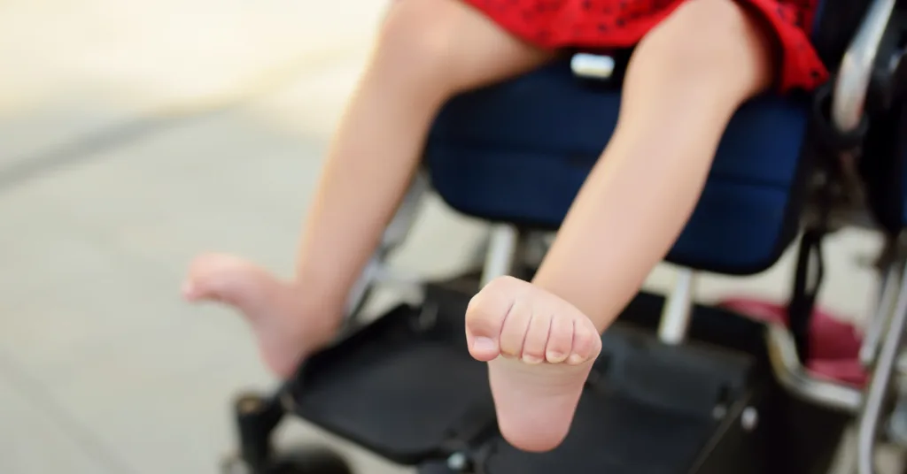 Muscle Stiffness in Cerebral Palsy: Botox's Breakthrough in Enhancing Mobility and Comfort
