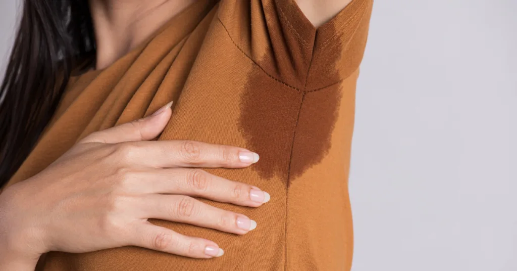 Hyperhidrosis: An In-Depth Exploration Beyond Mere Perspiration