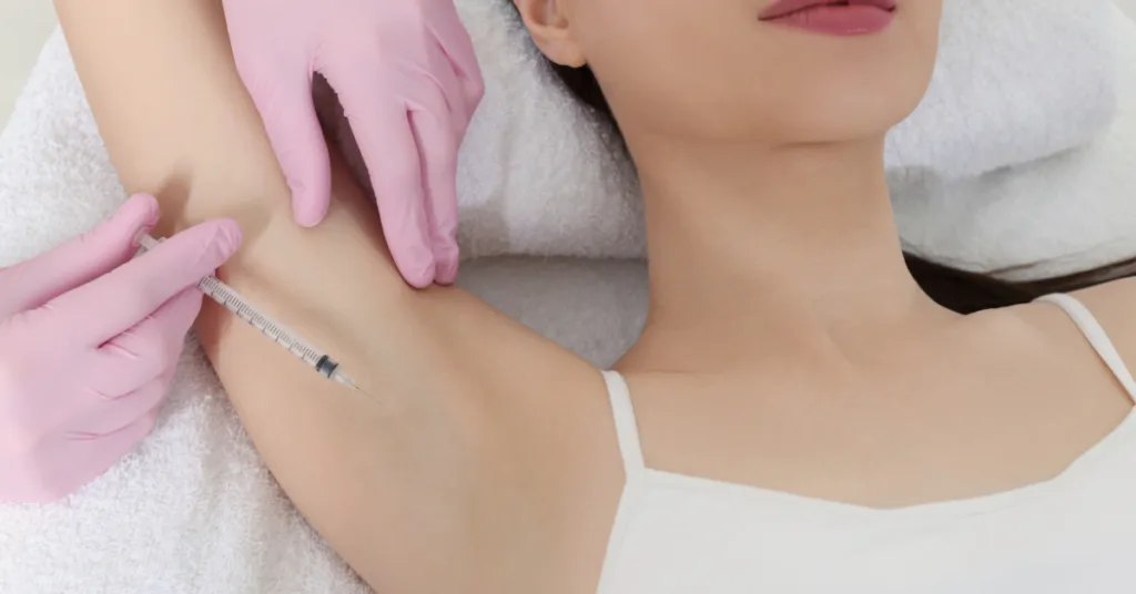 The Botox Procedure for Hyperhidrosis