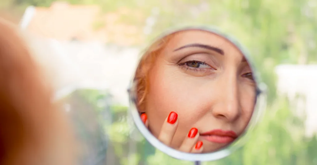 Understanding Nasolabial Folds