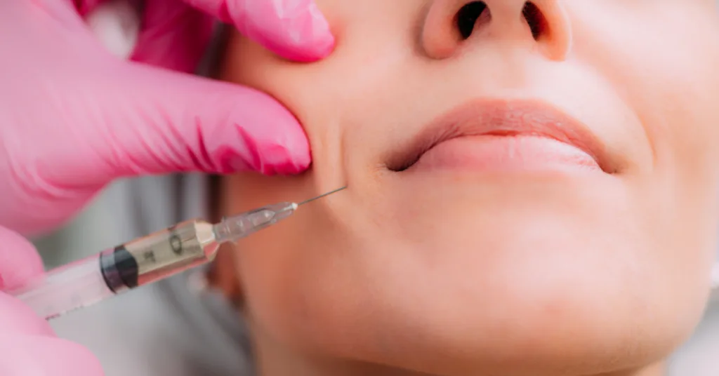 Botox for Nasolabial Folds: Smoothing Laugh Lines Conclusion