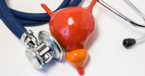 OAB and Botox: A Revolutionary Approach to Overactive Bladder Treatment